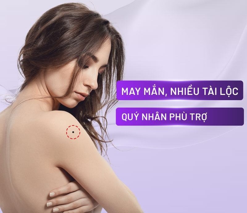 Nốt ruồi cánh tay