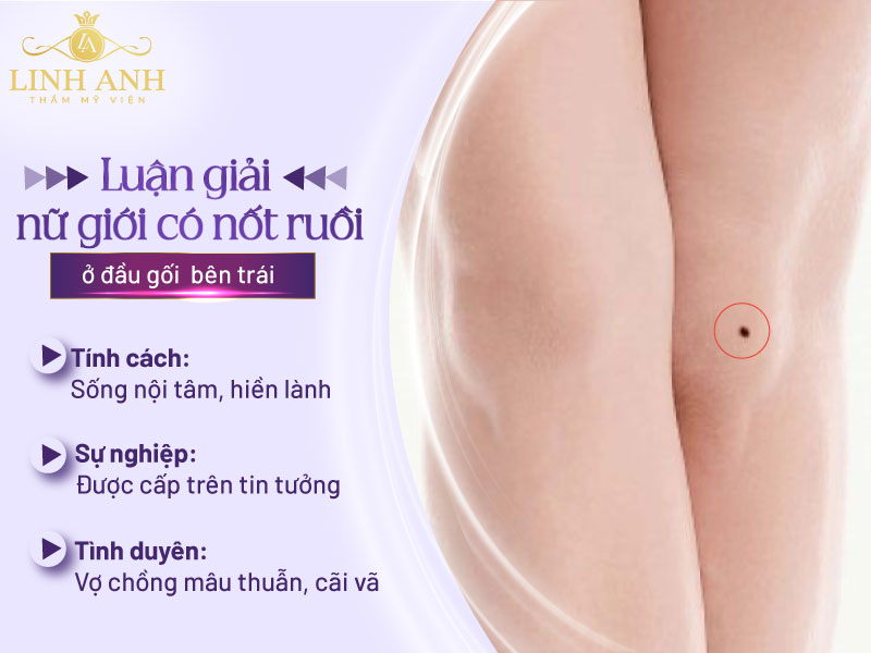 nốt ruồi đầu gối trái