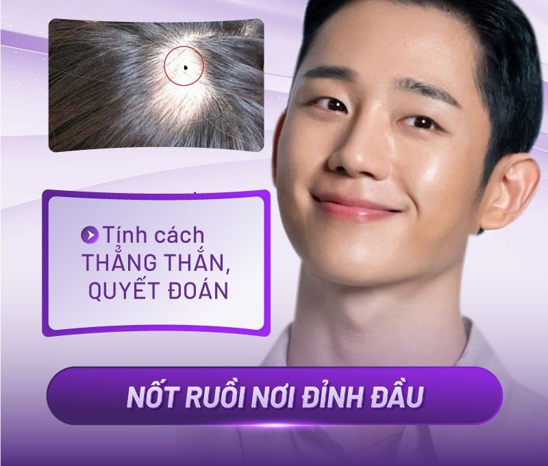 nốt ruồi đỉnh đầu nốt ruồi đỉnh đầu