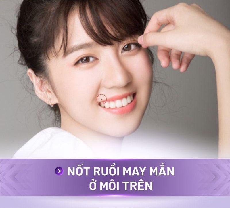 Nốt ruồi may mắn ở trên môi