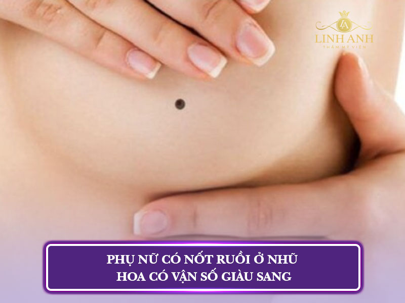 nốt ruồi ngay ngực