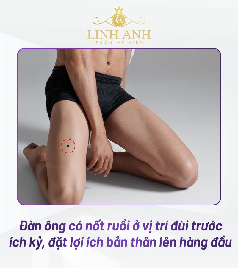 nốt ruồi nữ mọc đùi trước