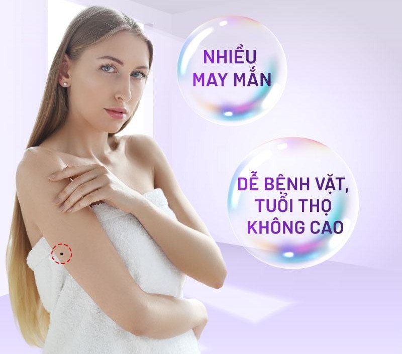 Nốt ruồi ở bắp tay