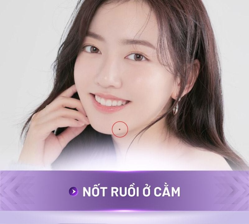 Nốt ruồi ở cằm không nên tẩy