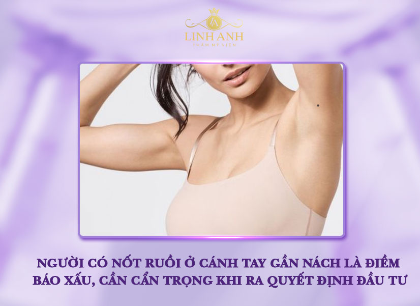 Nốt ruồi ở cánh tay gần nách