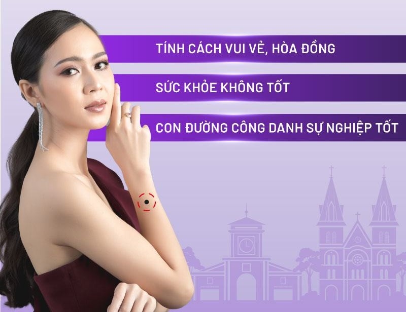 Nốt ruồi ở cánh tay phải phụ nữ
