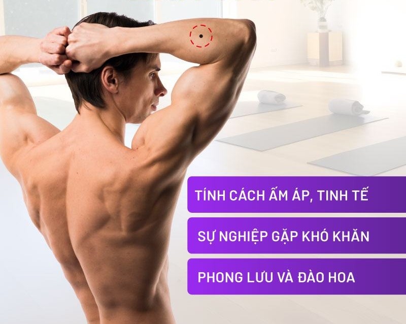 Nốt ruồi ở cánh tay phải