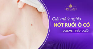 Nốt ruồi ở cổ