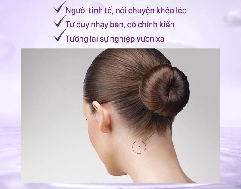 Nốt ruồi ở cổ bên trái