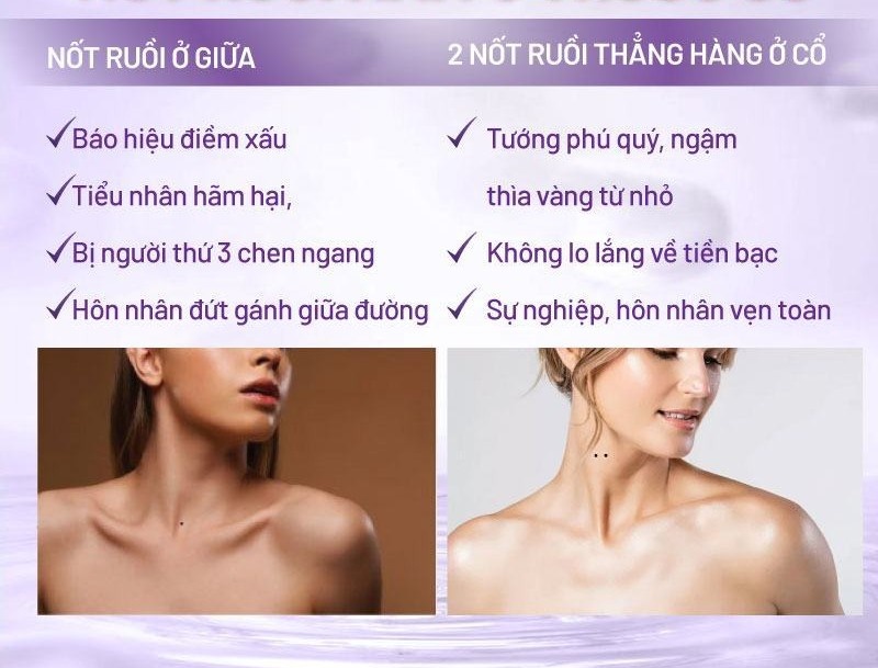 Nốt ruồi ở cổ phụ nữ