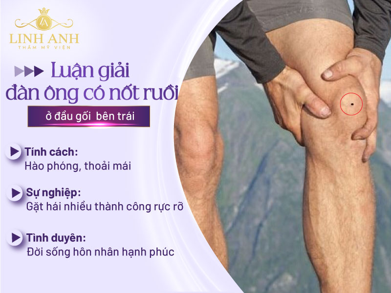 nốt ruồi ở đầu gối đàn ông