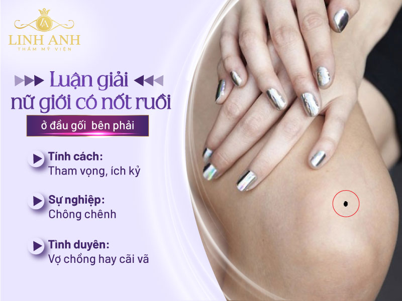 nốt ruồi ở đầu gối trái phụ nữ