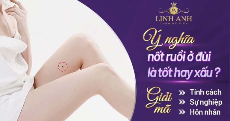 Ý nghĩa nốt ruồi ở đùi nam và nữ là tốt hay xấu?
