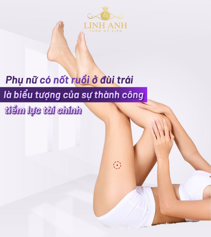 nốt ruồi ở đùi phải