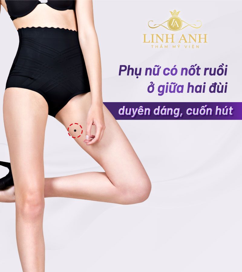 Nốt ruồi ở đùi trước