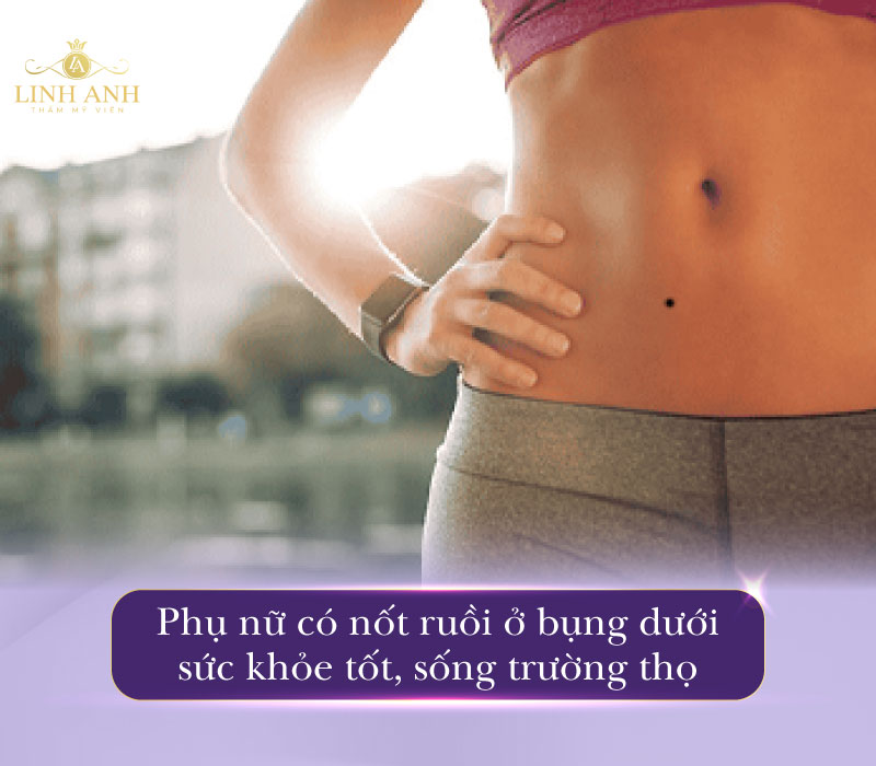 Nốt ruồi ở dưới bụng phụ nữ