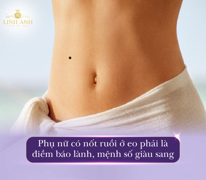 Nốt ruồi ở eo phải