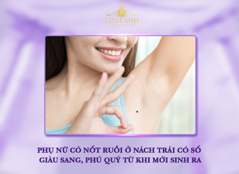 Nốt ruồi ở gần nách trái phụ nữ