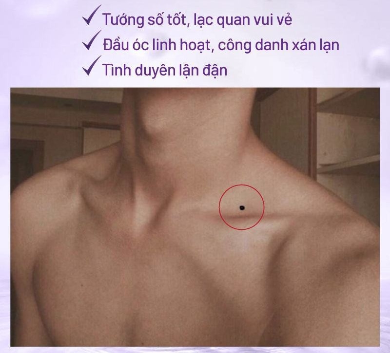 Nốt ruồi ở hõm cổ