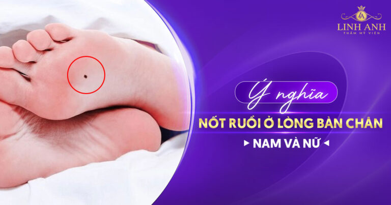 Nốt ruồi ở lòng bàn chân trái và phải có ý nghĩa gì?