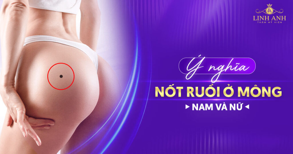 nốt ruồi ở mông