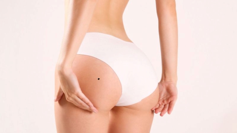 nốt ruồi ở mông trái phụ nữ