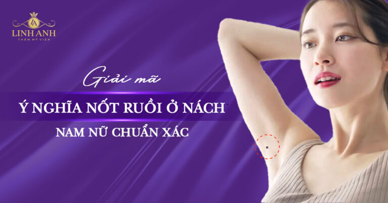 Nốt ruồi ở nách là phú quý hay khó khăn? Có nên xóa không?