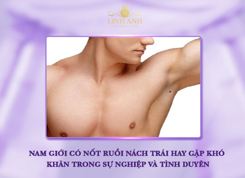 Nốt ruồi ở nách trái của nam
