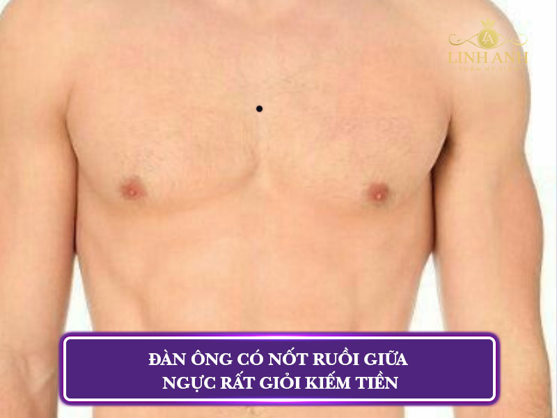 nốt ruồi ở ngực nam và nữ