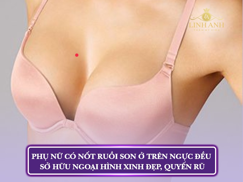 nốt ruồi ở ngực phải
