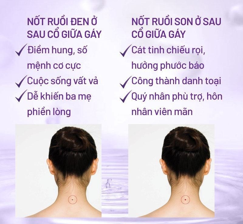 Nốt ruồi ở sau cổ giữa gáy