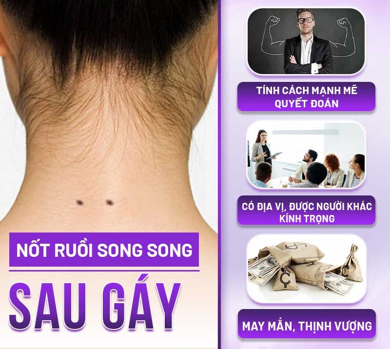 nốt ruồi ở sau gáy
