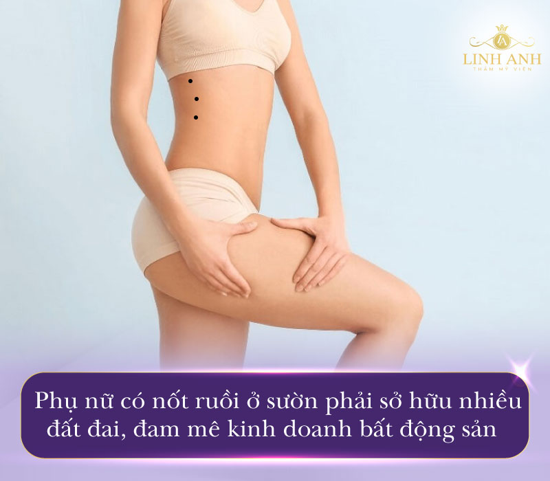 Nốt ruồi ở sườn bụng