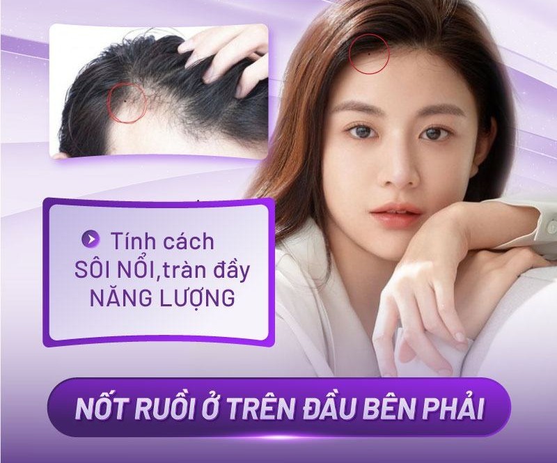 nốt ruồi ở trên đầu nốt ruồi ở trên đầu