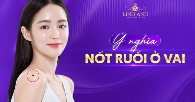 Luận giả ý nghĩa nốt ruồi ở vai ở nam và nữ – Tốt hay xấu?
