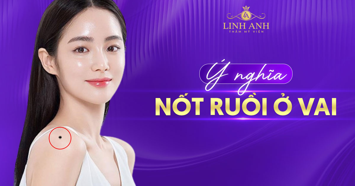 nốt ruồi ở vai