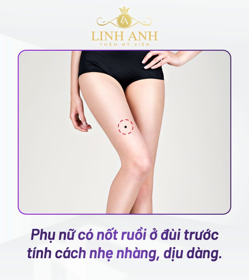 Nốt ruồi ở vị trí sau đùi