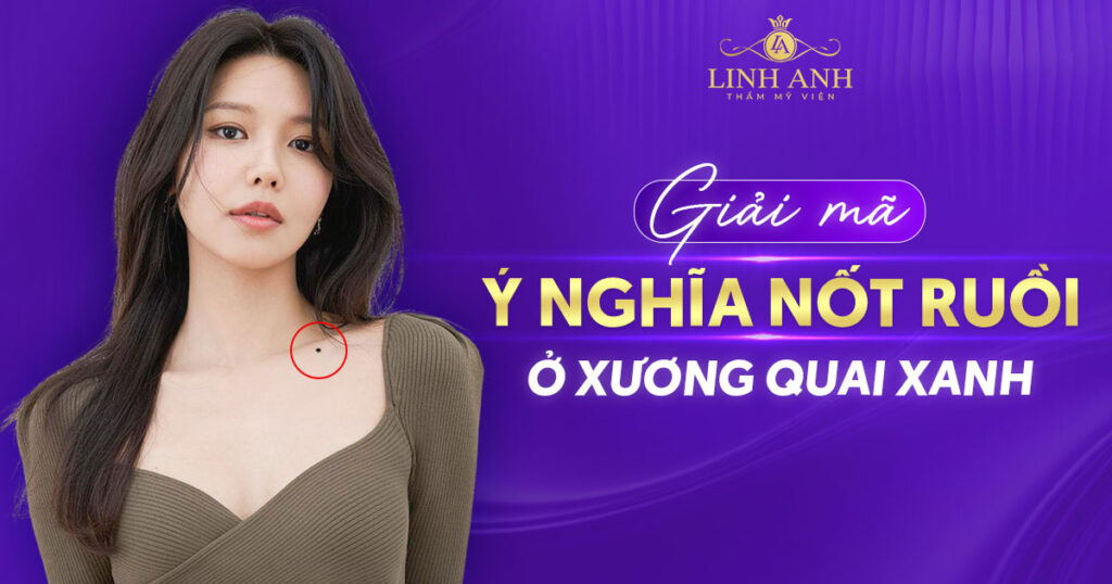Nốt ruồi ở xương quai xanh