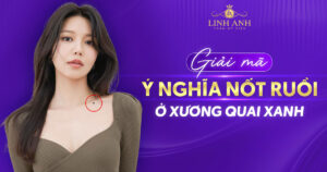Nốt ruồi ở xương quai xanh