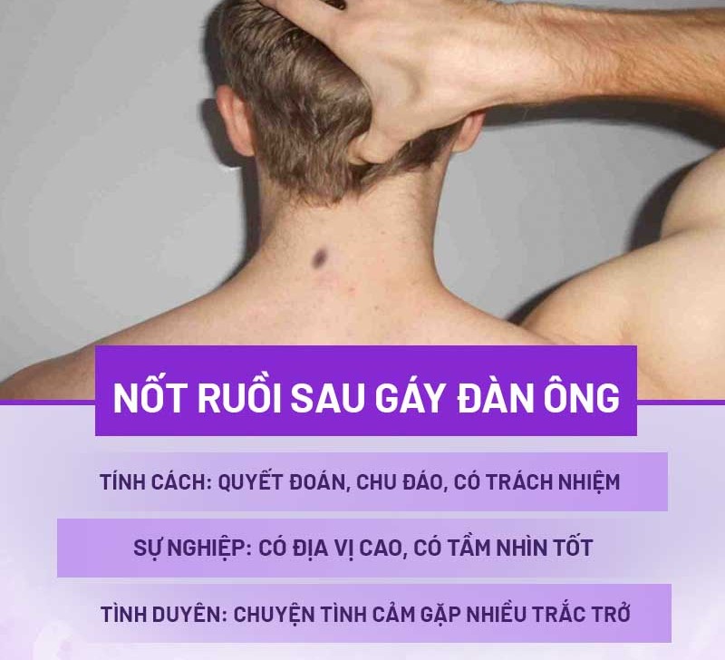 nốt ruồi sau gáy nam