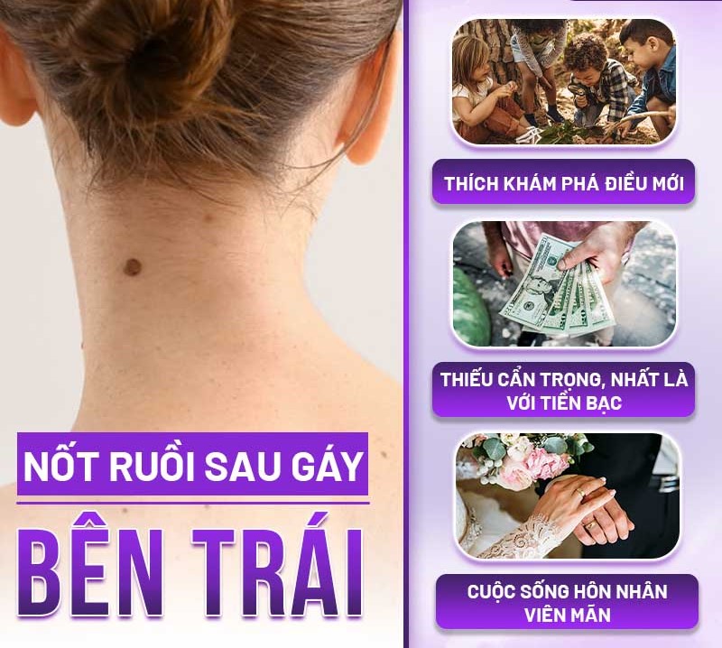 nốt ruồi sau gáy phụ nữ
