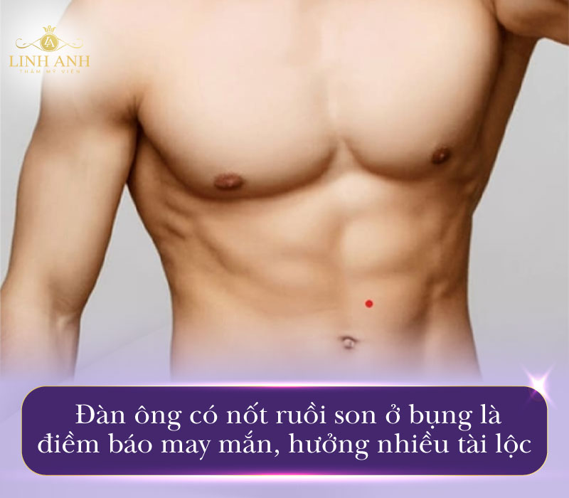Nốt ruồi son ở bụng nam giới
