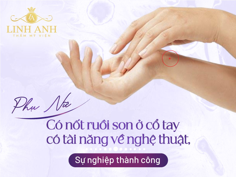 Nốt ruồi son ở cổ tay