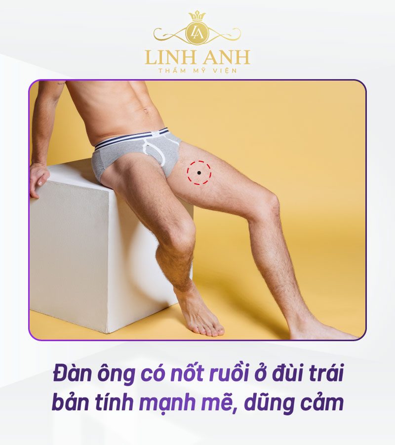 nốt ruồi son ở đùi