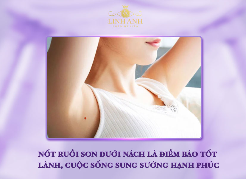 Nốt ruồi son ở nách