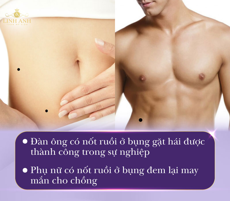 Nốt ruồi trên bụng