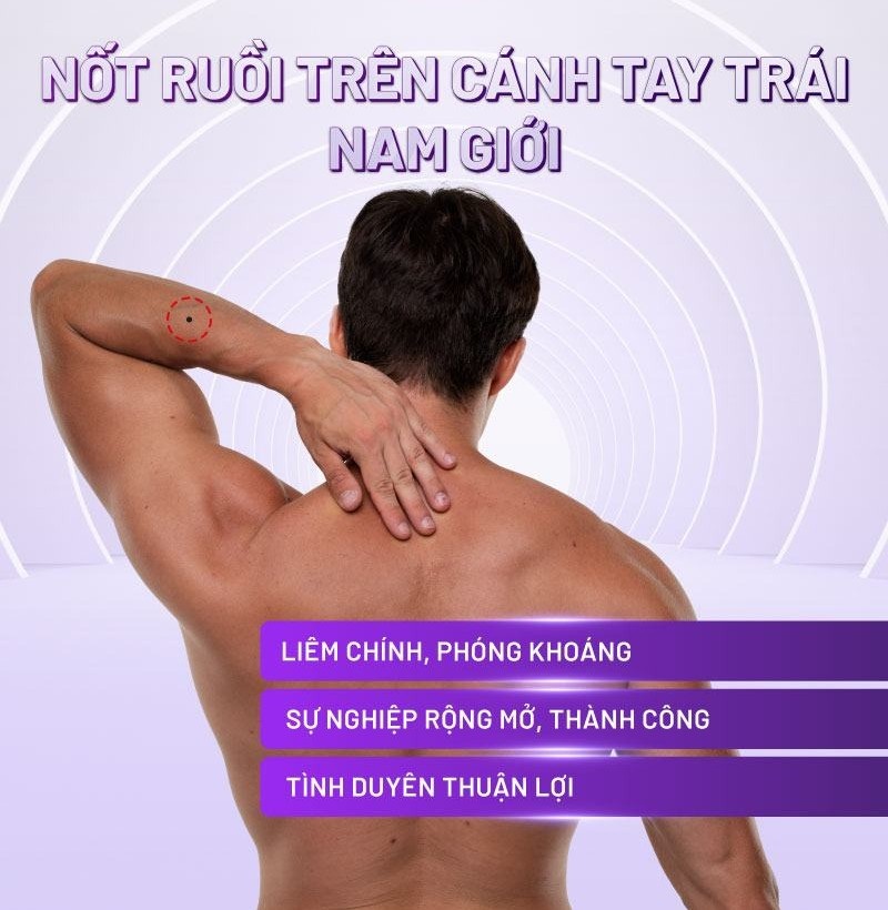 Nốt ruồi trên cánh tay