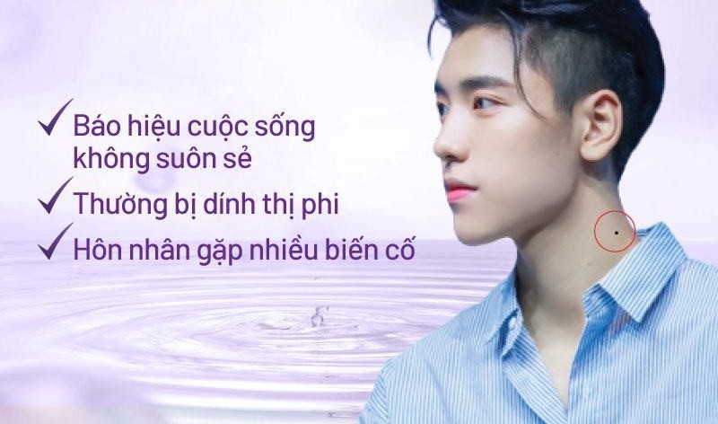 Nốt ruồi trên cổ nam Nốt ruồi trên cổ nam