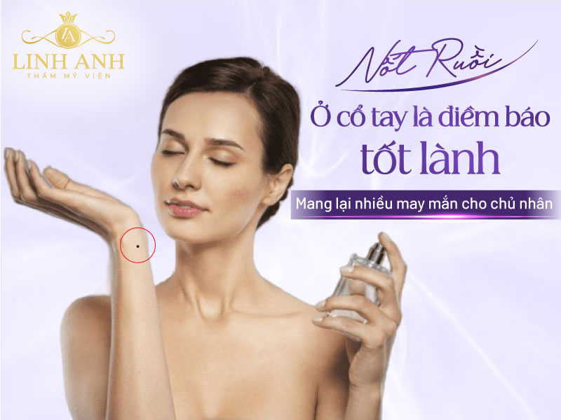 Nốt ruồi trên cổ tay