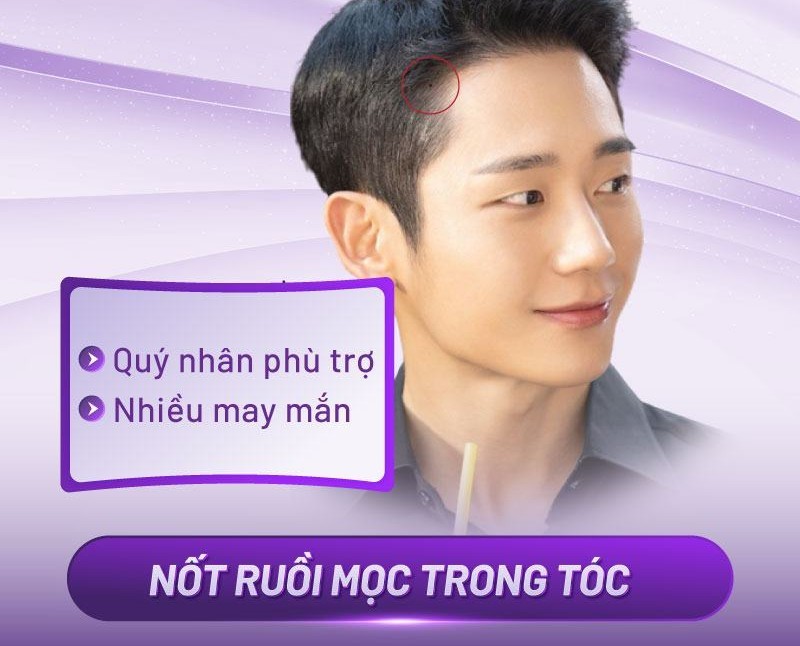 nốt ruồi trên da đầu nốt ruồi trên da đầu